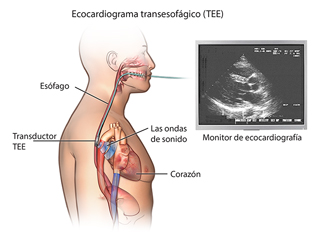 Vista lateral del pecho superior y la garganta de un hombre, mostrando endoscopio y ondas de sonido. 